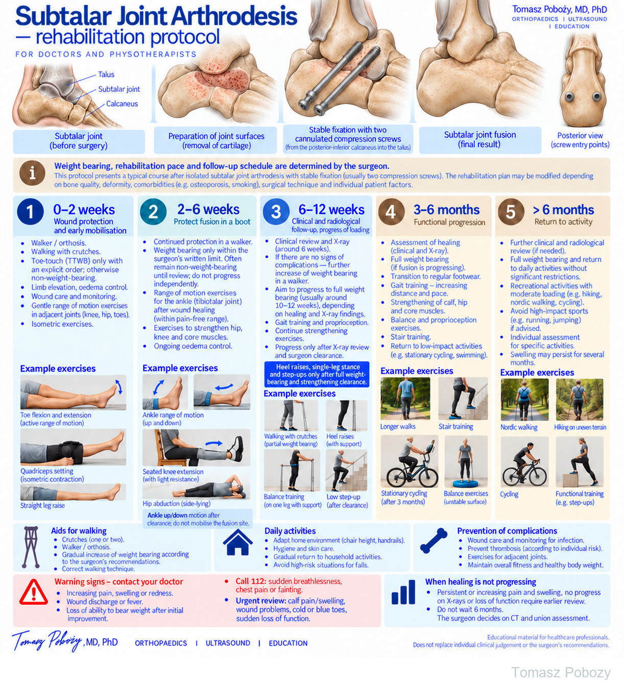 Subtalar joint arthrodesis — stable fixation with two compression screws and five rehabilitation stages. · board 1/1. Prepared by Tomasz Poboży — orthopaedic surgeon.