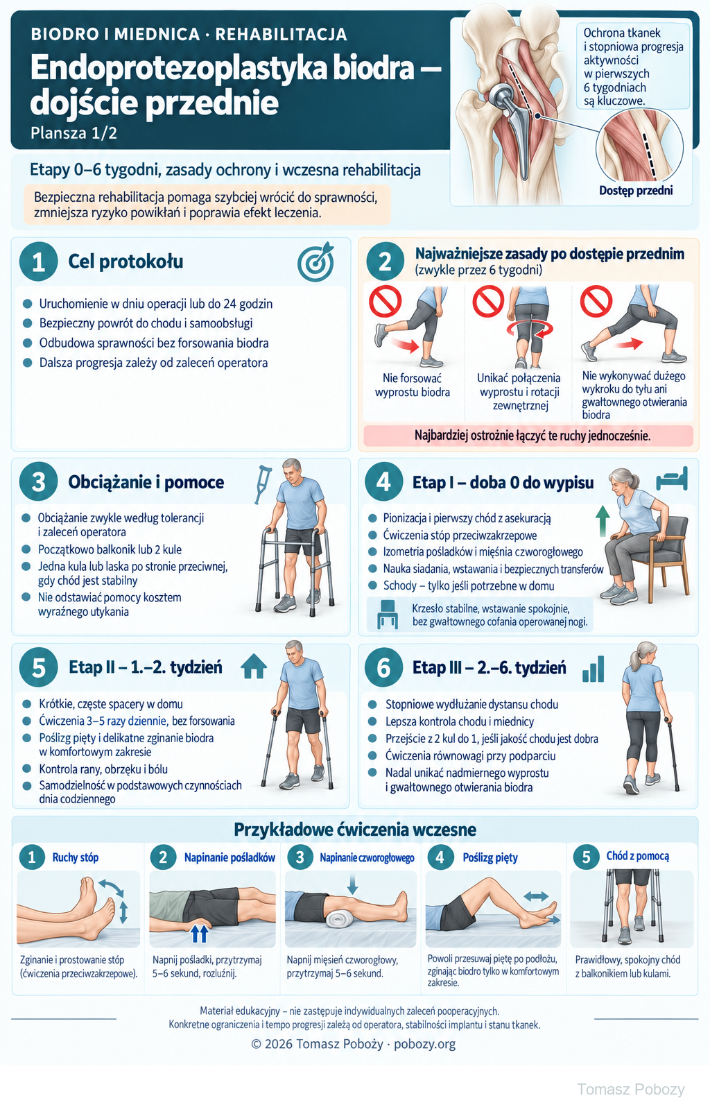 Endoprotezoplastyka biodra — dojście przednie. Zasady ochrony po dojściu przednim, obciążanie i wczesne ćwiczenia do 6. tygodnia. Opracowanie merytoryczne: Tomasz Poboży - ortopeda.