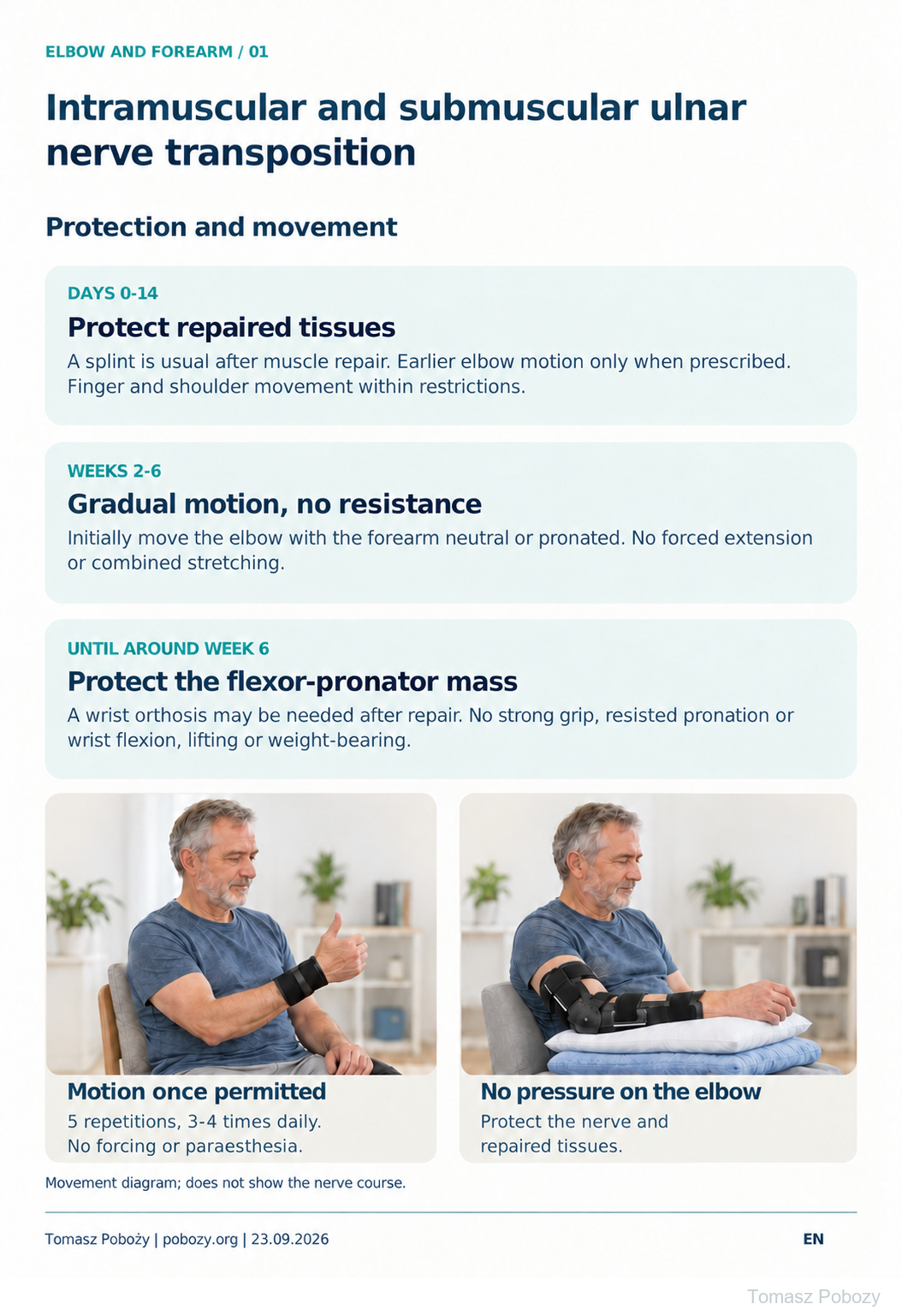 Postoperative rehabilitation: Intramuscular and submuscular ulnar nerve transposition: a man demonstrating cleared motion and prescribed splint protection of repaired tissues. Prepared by Tomasz Poboży — orthopaedic surgeon.