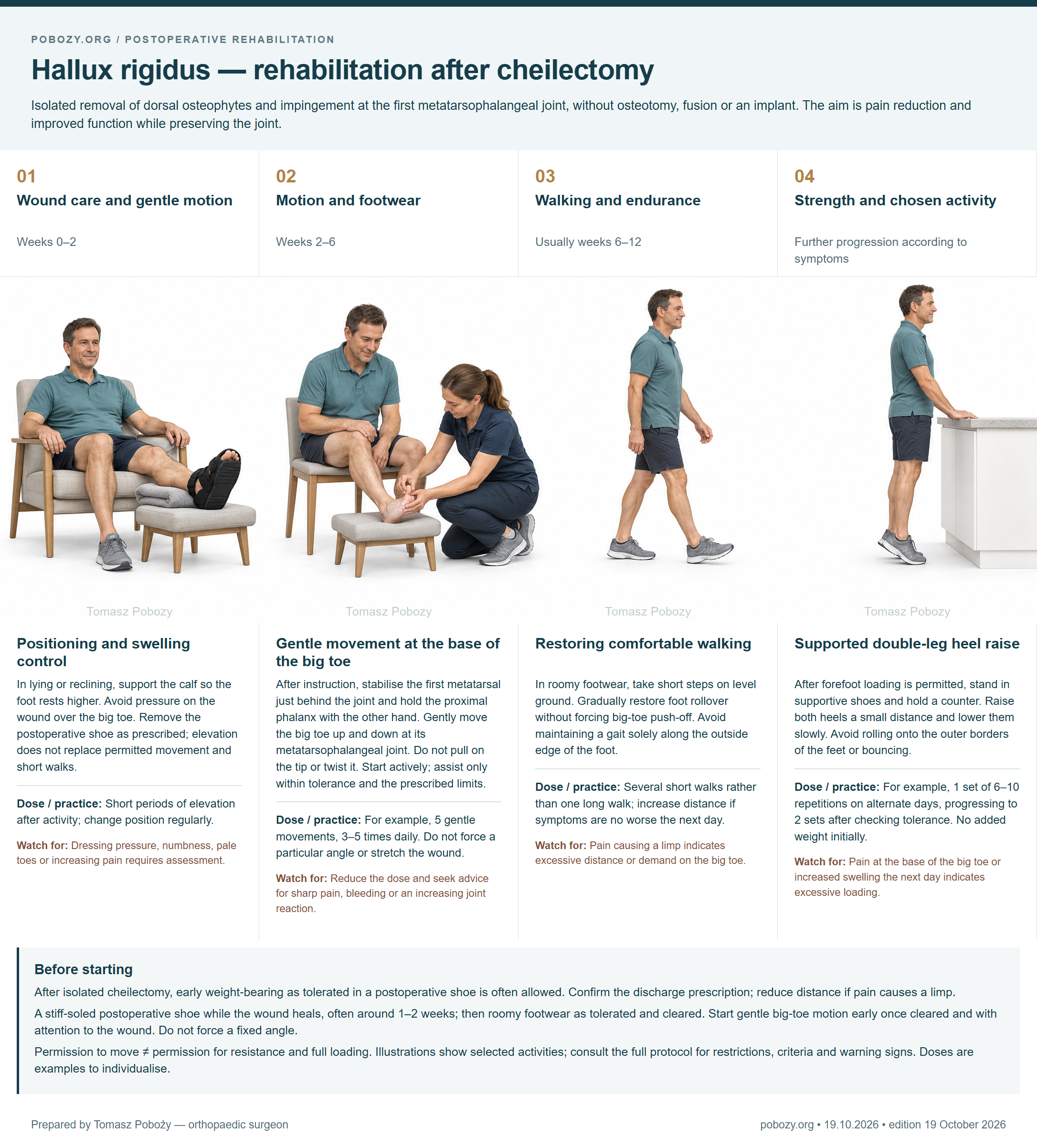 Hallux rigidus — rehabilitation after cheilectomy. Four phases: Positioning and swelling control, Gentle movement at the base of the big toe, Restoring comfortable walking, Supported double-leg heel raise. Prepared by Tomasz Poboży — orthopaedic surgeon.