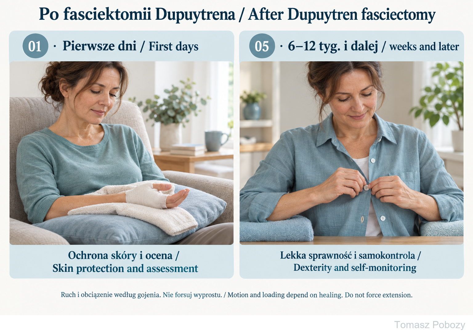 Dupuytren contracture surgery — rehabilitation after limited fasciectomy — phase-specific examples; clearance is required. Prepared by Tomasz Poboży — orthopaedic surgeon.