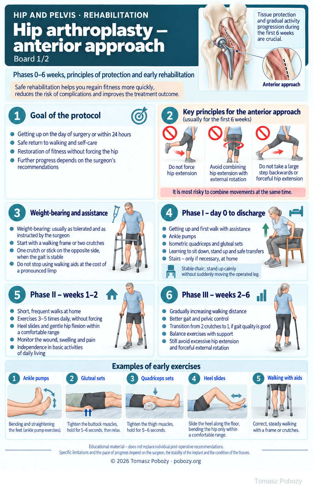 Hip arthroplasty — anterior approach. Anterior-approach precautions, weight bearing and early exercises through week 6. Medical content prepared by: Tomasz Poboży - orthopaedic surgeon.