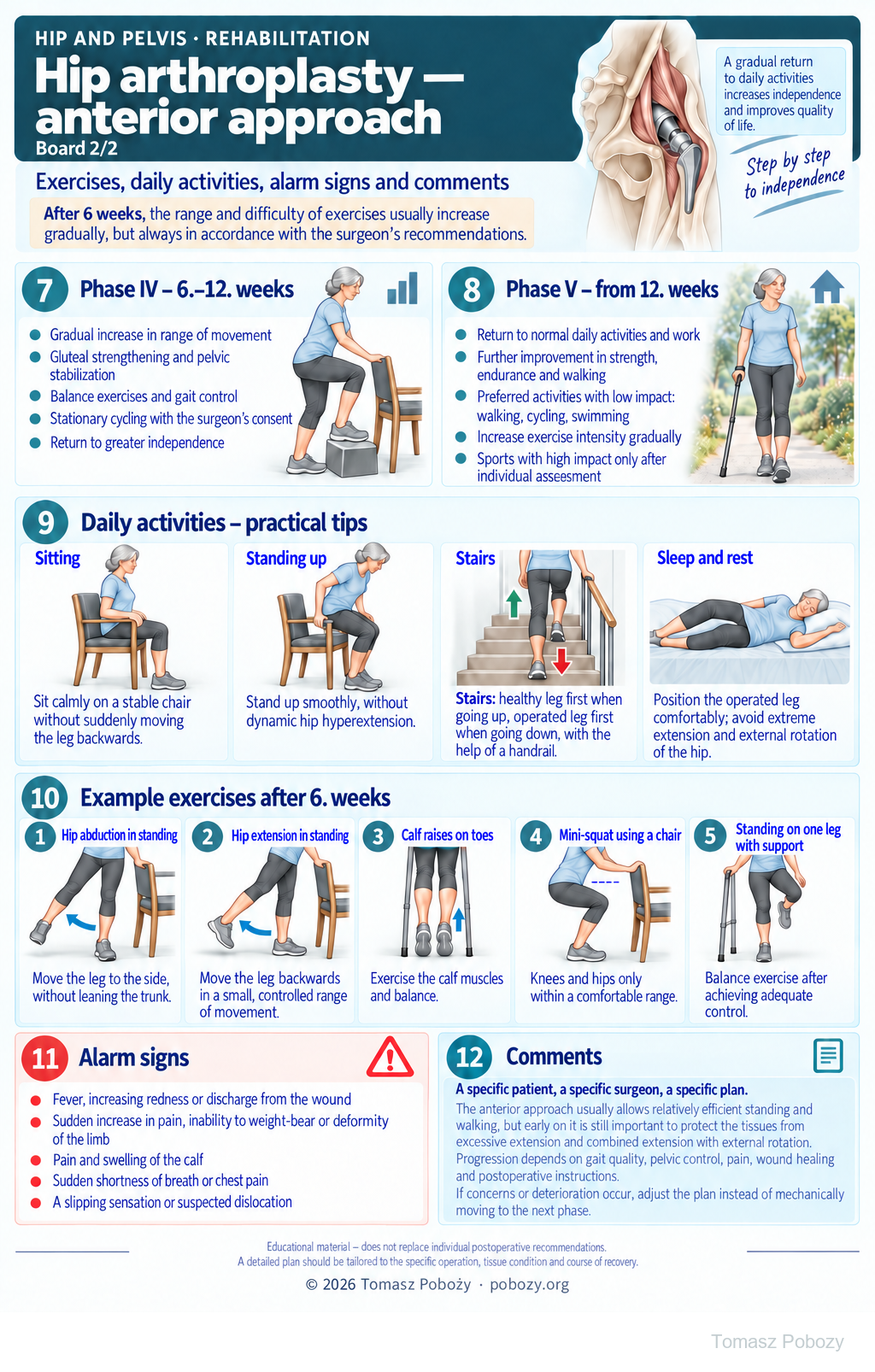 Hip arthroplasty — anterior approach. Stages from week 6, exercises, daily activities and warning signs. Medical content prepared by: Tomasz Poboży - orthopaedic surgeon.