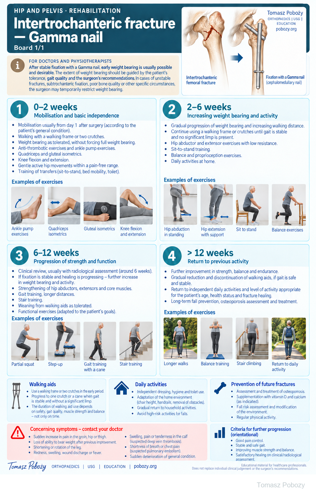 Intertrochanteric fracture — Gamma nail. Gamma nail fixation, individual weight bearing, four exercise stages and warning signs. Medical content prepared by: Tomasz Poboży - orthopaedic surgeon.