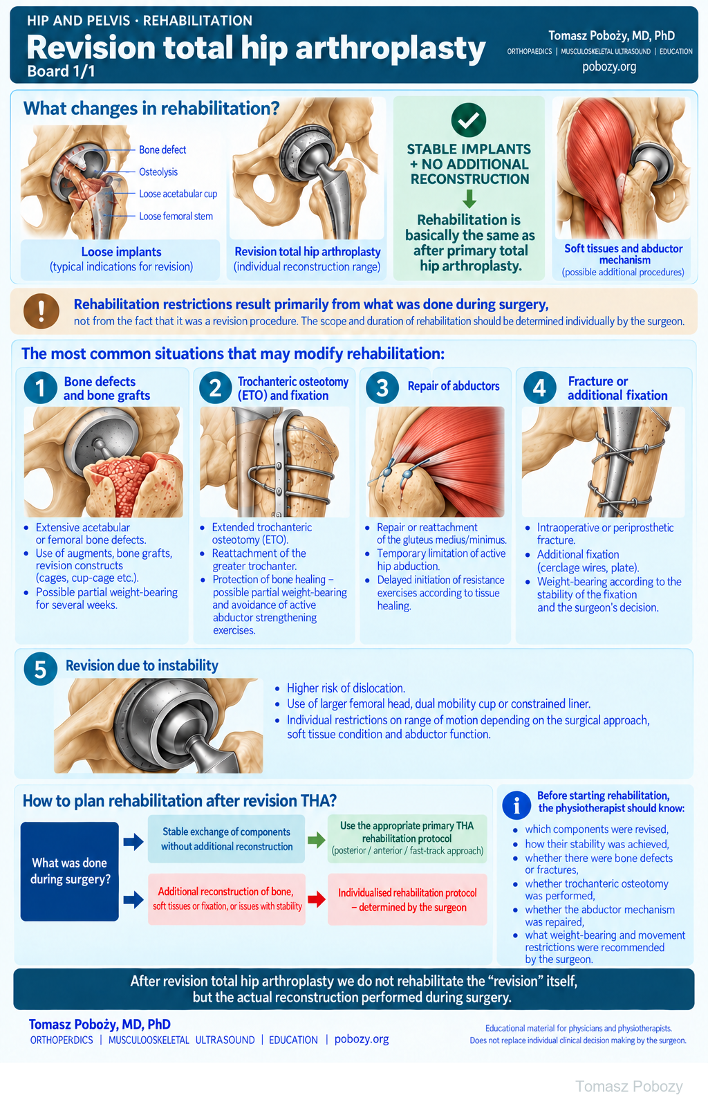 Revision total hip arthroplasty. Five situations requiring modified rehabilitation and a decision pathway based on the reconstruction performed. Medical content prepared by: Tomasz Poboży - orthopaedic surgeon.