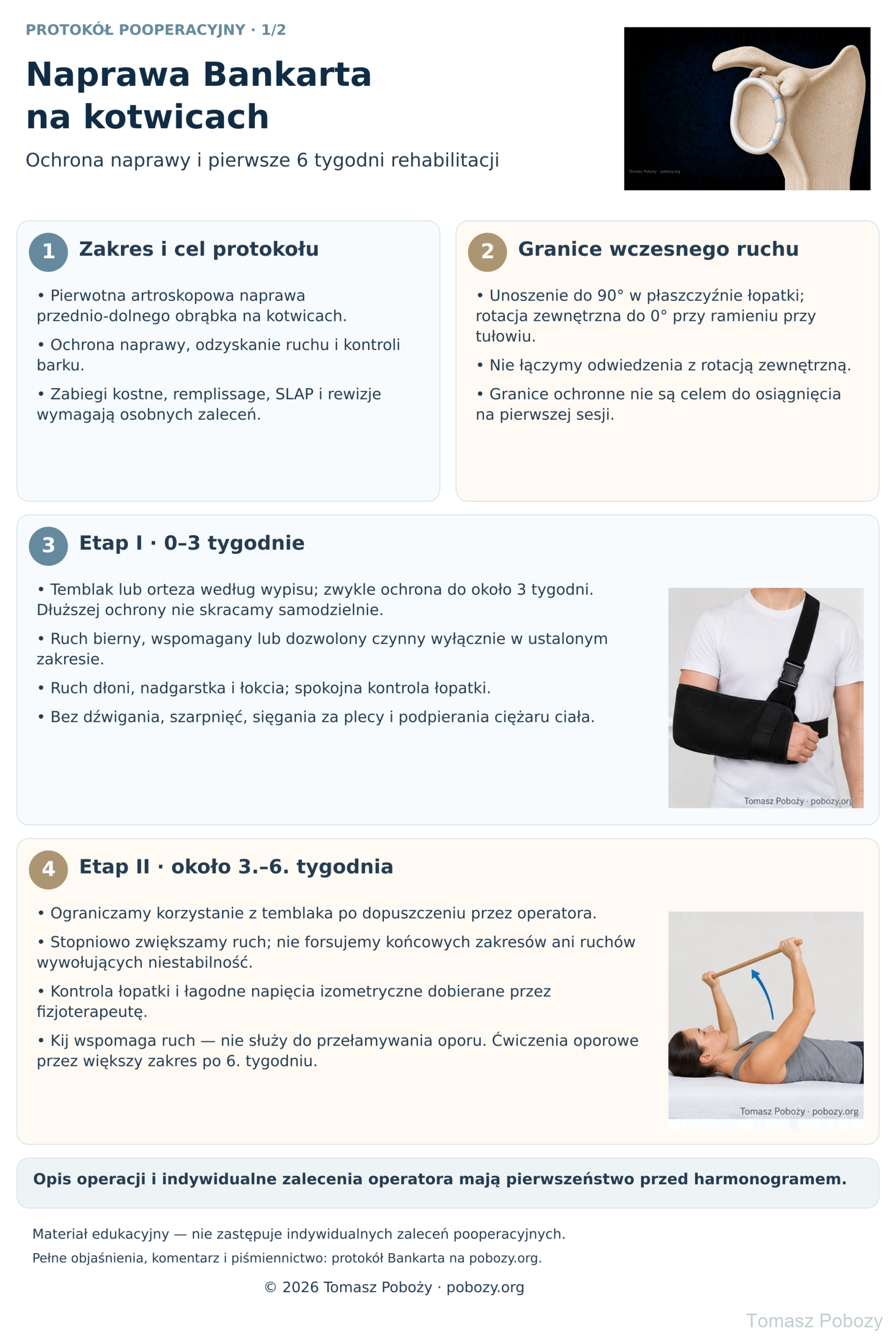 Rehabilitacja po naprawie Bankarta na kotwicach: ochrona barku, ruch i ćwiczenia w pierwszych 6 tygodniach. · plansza 1/2. Opracował Tomasz Poboży — ortopeda.
