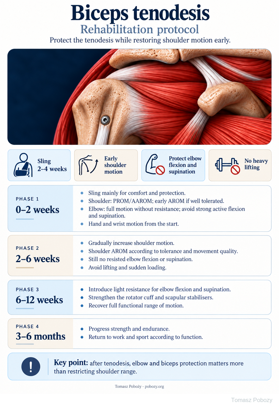 Postoperative rehabilitation: Biceps tenodesis — English protocol: protection of fixation, early shoulder motion, phases 0–2, 2–6 and 6–12 weeks, then 3–6 months. · board 1/1. Prepared by Tomasz Poboży — orthopaedic surgeon.