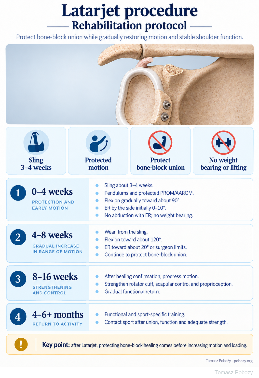 Postoperative rehabilitation: Latarjet procedure — English poster: protection of bone-block union, phases 0–4, 4–8 and 8–16 weeks, and return to sport from months 4–6 or later. · board 1/1. Prepared by Tomasz Poboży — orthopaedic surgeon.