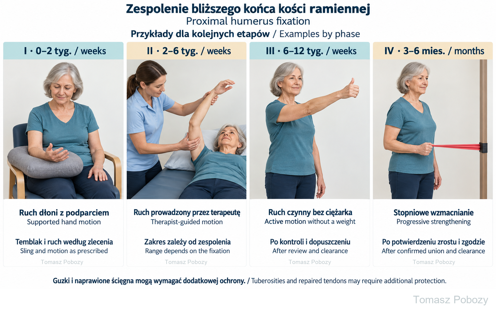Proximal humerus fracture fixation — rehabilitation protocol — examples in all four phases. Prepared by Tomasz Poboży — orthopaedic surgeon.