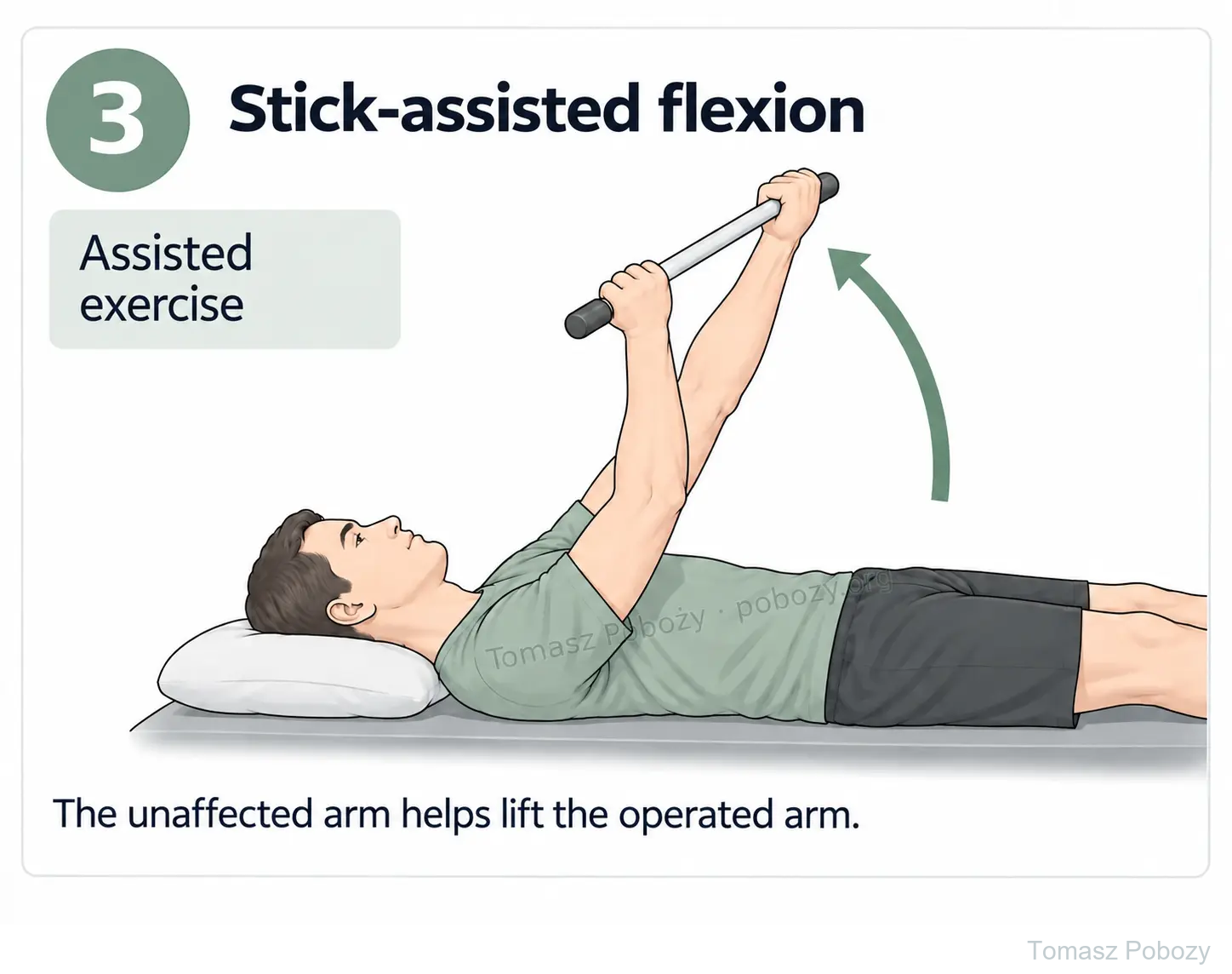 Postoperative rehabilitation: Stick-assisted flexion: the unaffected arm helps lift the operated arm while the patient lies on his back. Prepared by Tomasz Poboży — orthopaedic surgeon.