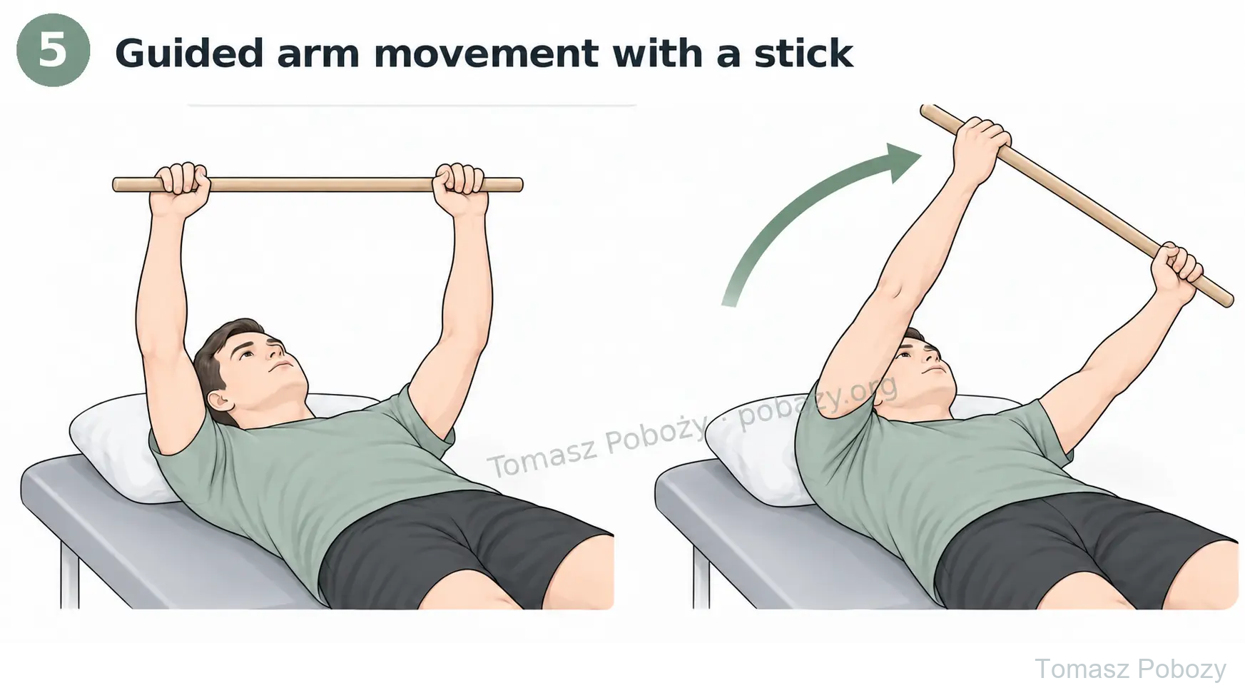 Postoperative rehabilitation: Guided arm movement with a stick, shown in two positions with the patient lying on his back. Prepared by Tomasz Poboży — orthopaedic surgeon.